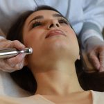 Microneedling: Wie der Dermapen für bessere Haut sorgen soll – bei Aknenarben und Falten